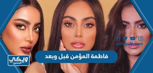 فاطمة الانصاري قبل وبعد